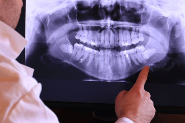 Best Emergency Treatment for Toothache in Deer Park, OH